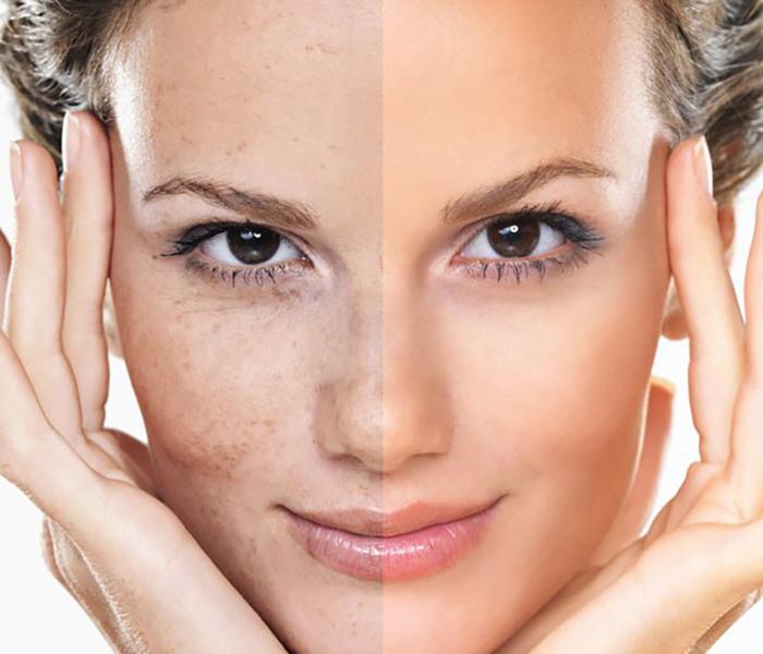 natural-method-of-skin-care